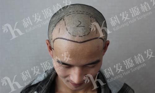 无敌天下
